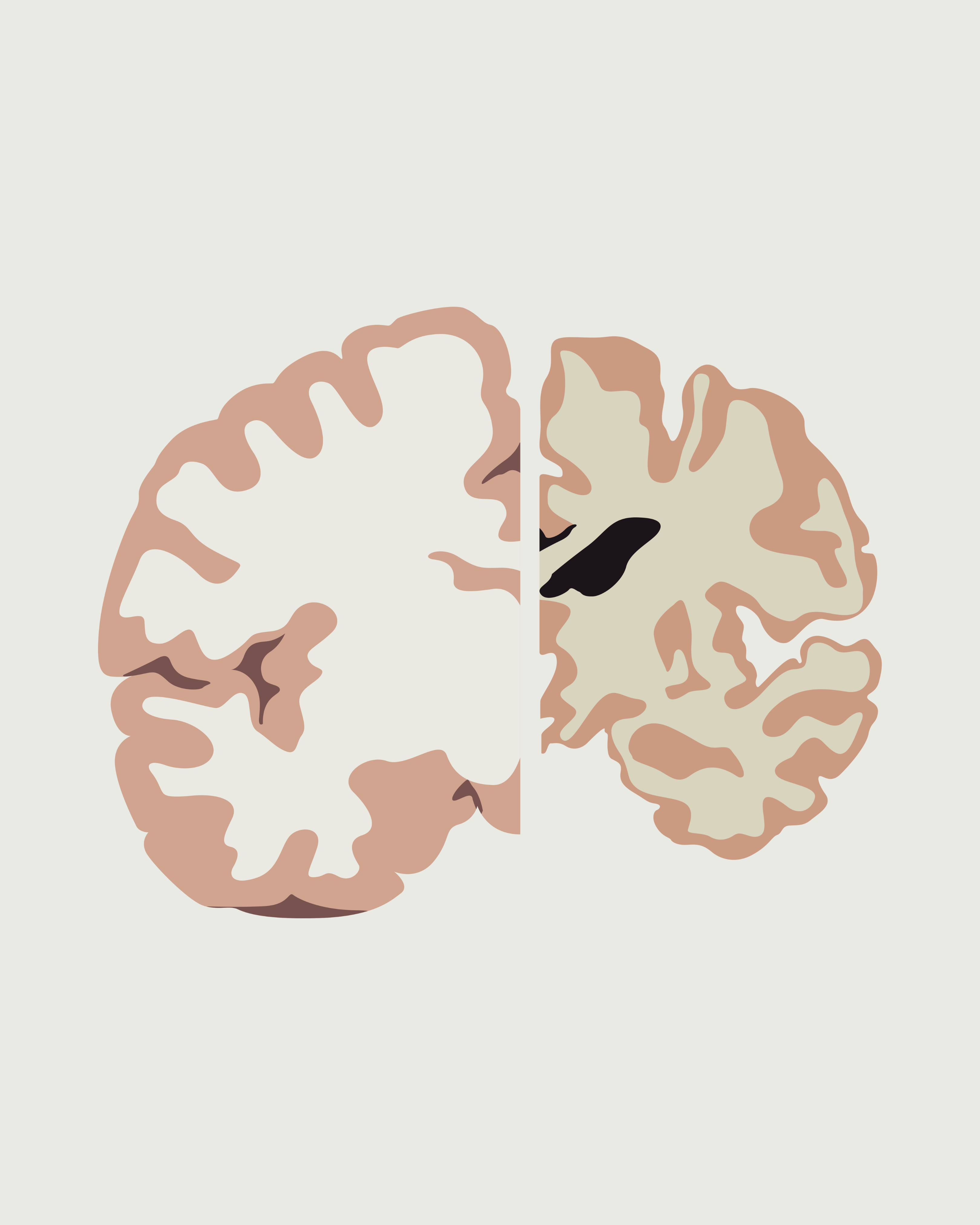 Breakthrough in Alzhemers